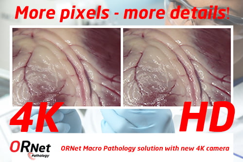 ORNet macro pathology solution with 4k camera