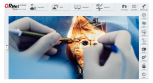 ORNet operating room integration & management system with 4K video