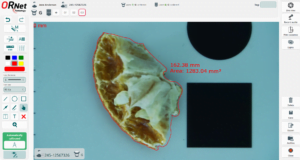 Image editor for gross pathology imaging and editing