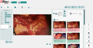 Digital imaging in gross pathology