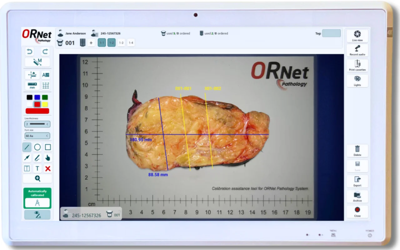 Modern Gross Pathology with ORNet Pathology (1) Modern Gross Pathology with ORNet Pathology
