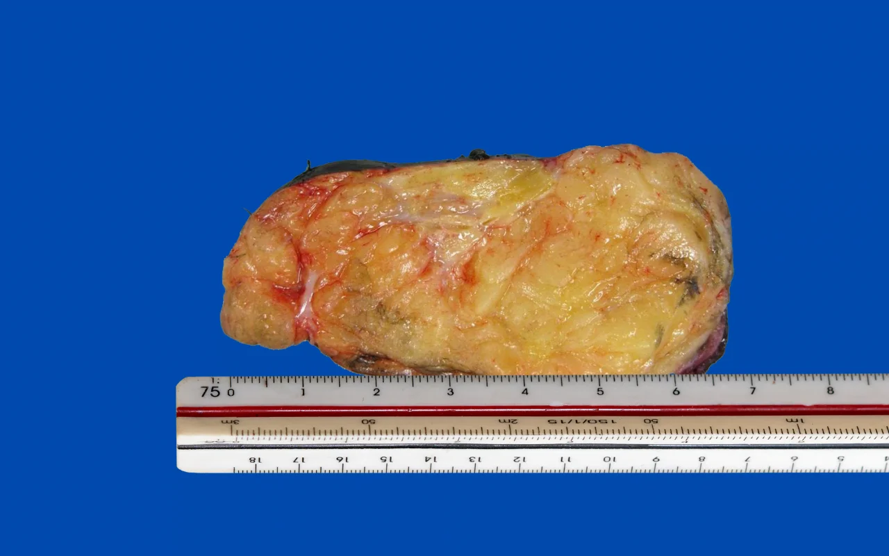 Traditional Pathology Grossing Traditional Pathology Grossing